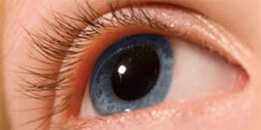 What Are the Warning Signs of Keratoconus and How Can It Be Treated?
